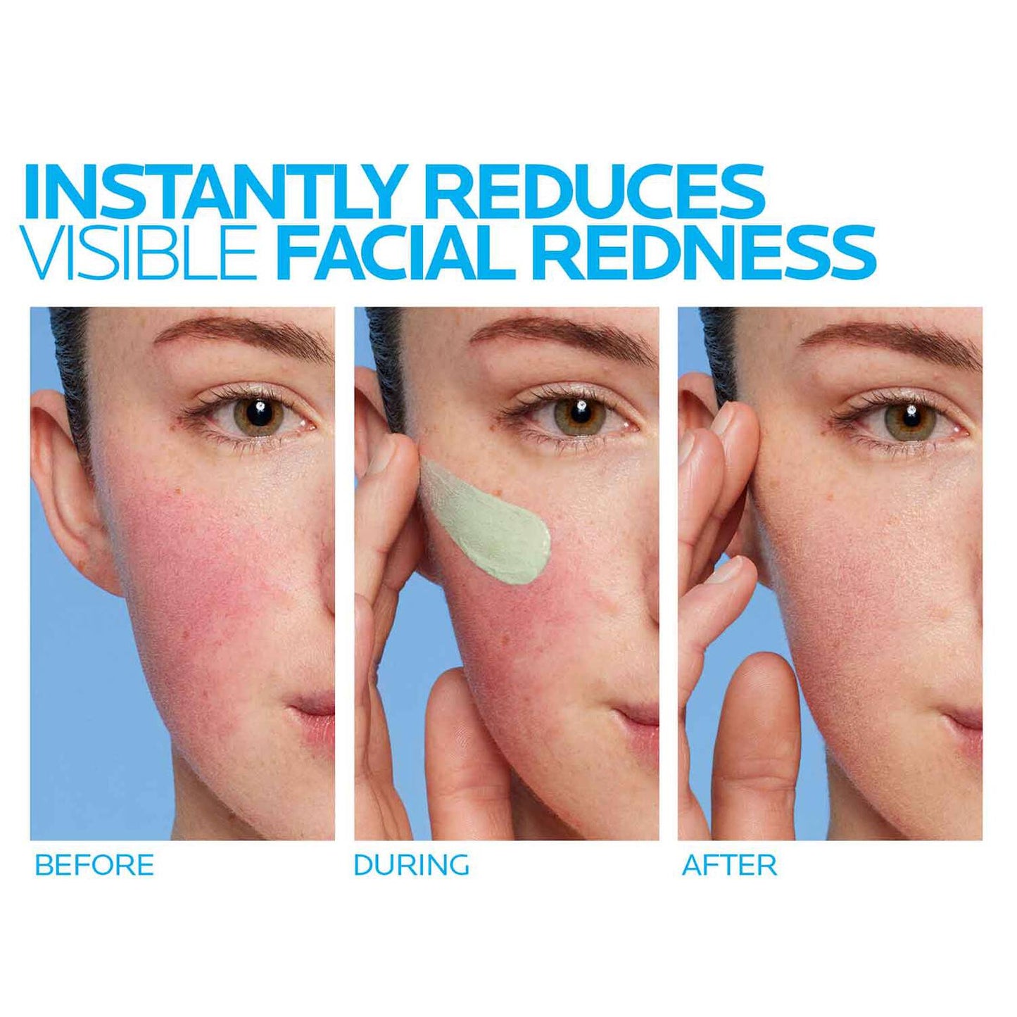 toleriane-rosaliac-ar-face-cream-for-visible-redness-w6 8_Toleriane_Rosaliac-AR-before-after.jpg