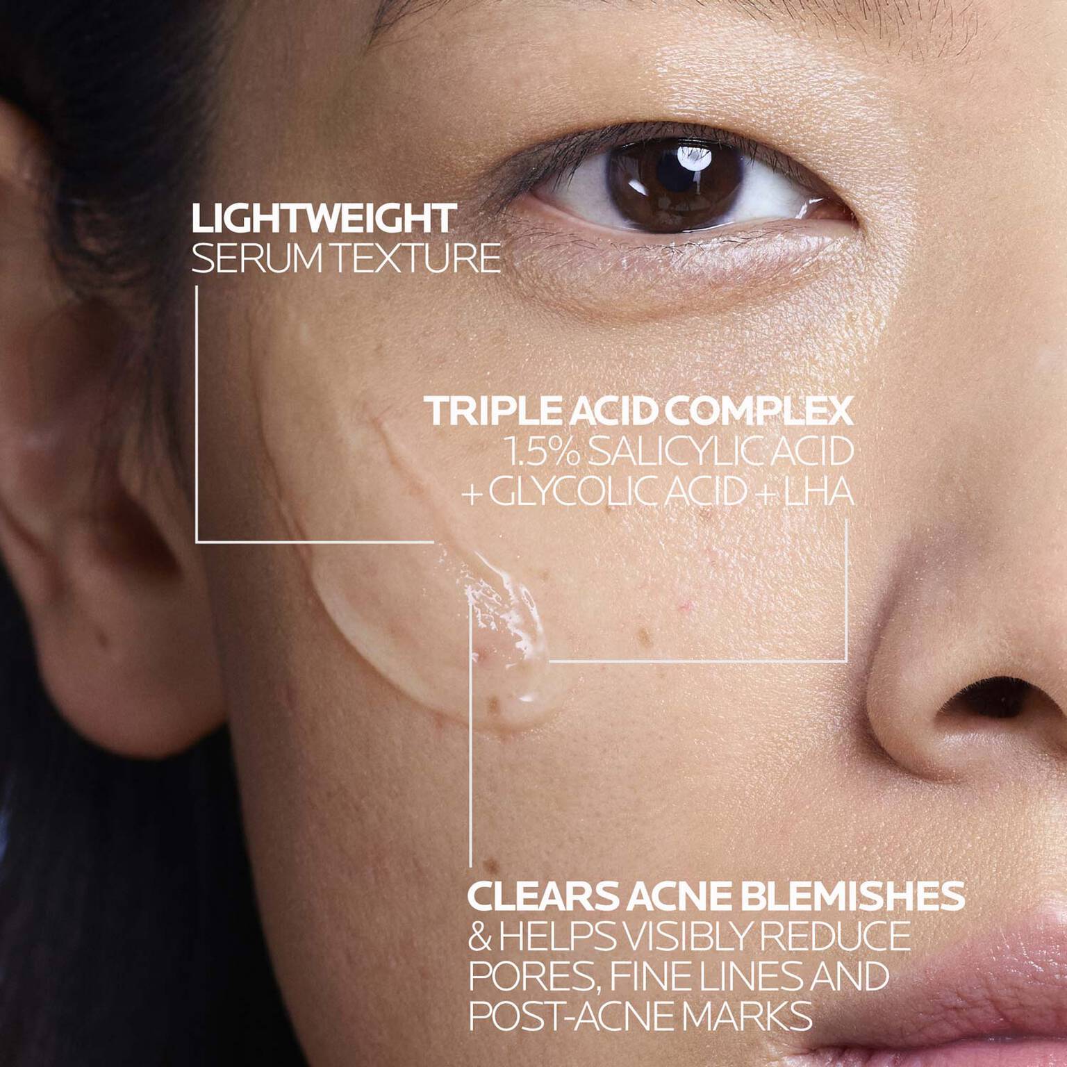 effaclar-salicylic-acid-acne-treatment-serum-z5 LaRochePosay-Product-Effaclar-Effaclar-Serum-30ml-3337875722827-Texture-REV.jpg