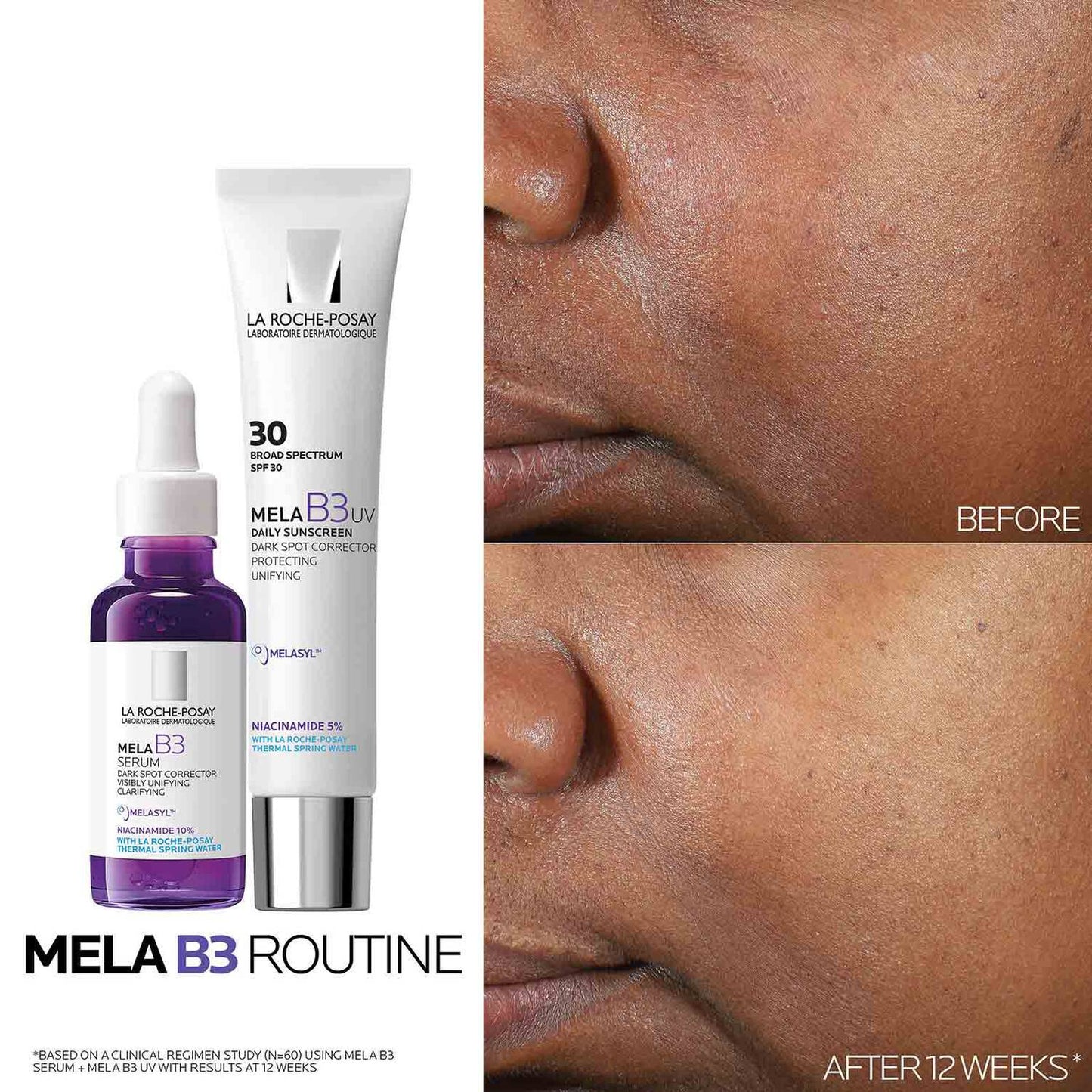 mela-b3-dark-spot-serum-with-melasyltm-niacinamide-o2 Mela-B3-routine_1500X1500.jpg