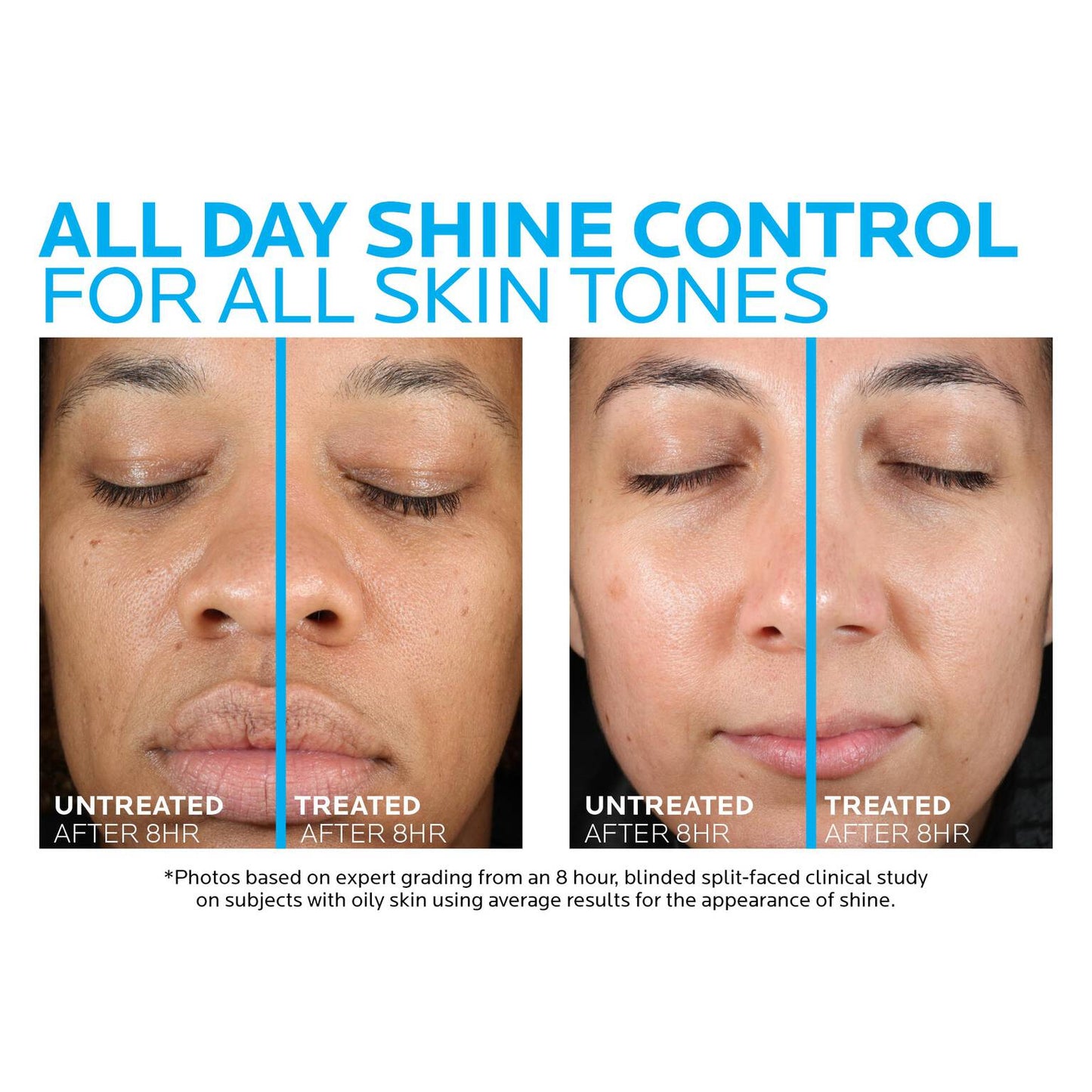 toleriane-double-repair-matte-face-moisturizer-for-oily-skin-s7 la-roche-posay-toleriane-matte-moisturizer-before-and-after-pdp-alt.jpg